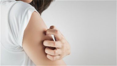 HOW TO FEEL CONFIDENT WITH ECZEMA HOW TO FEEL CONFIDENT WITH ECZEMA